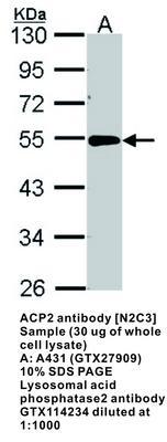 ACP2 antibody [N2C3], GeneTex