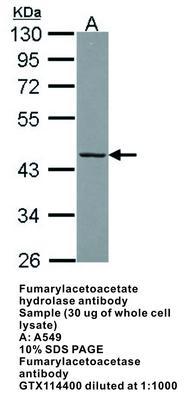 RB PAB TO FUMARYLACETOACETATE