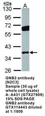 GNB2 antibody [N2C3], GeneTex