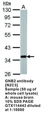 GNB2 antibody [N2C3], GeneTex