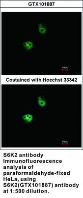 S6K2 antibody, GeneTex