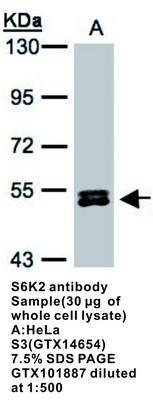 S6K2 antibody, GeneTex