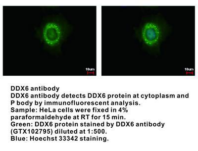 DDX6 antibody [N1N3], GeneTex