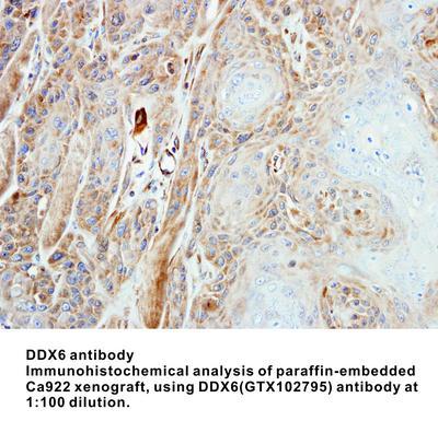 DDX6 antibody [N1N3], GeneTex