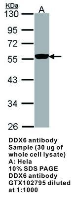 DDX6 antibody [N1N3], GeneTex