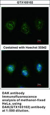 DAK antibody, GeneTex