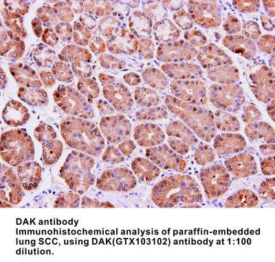 DAK antibody, GeneTex