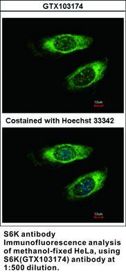 S6K antibody - Rabbit Polyclonal - ICC/IF, WB, GeneTex