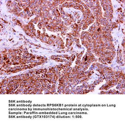 S6K antibody - Rabbit Polyclonal - ICC/IF, WB, GeneTex