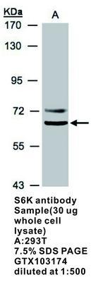 S6K antibody - Rabbit Polyclonal - ICC/IF, WB, GeneTex