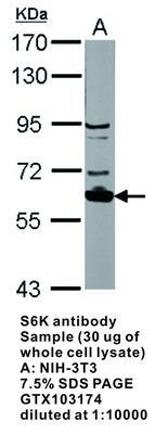 S6K antibody - Rabbit Polyclonal - ICC/IF, WB, GeneTex