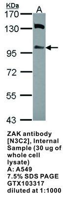 ZAK antibody [N3C2], Internal, GeneTex