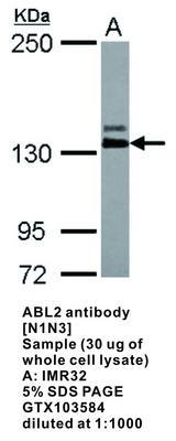 ABL2 antibody [N1N3], GeneTex