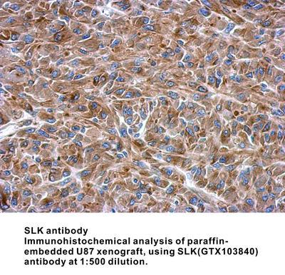 SLK antibody, GeneTex