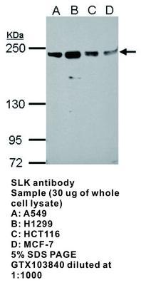 SLK antibody, GeneTex