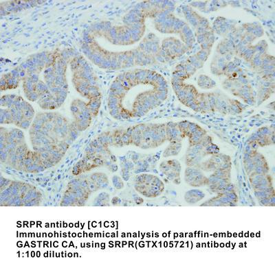 SRPR antibody [C1C3], GeneTex