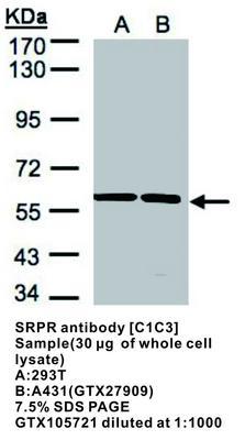 SRPR antibody [C1C3], GeneTex