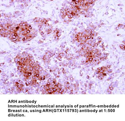 ARH antibody, GeneTex