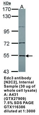 Edc3 antibody [N2C2], Internal, GeneTex