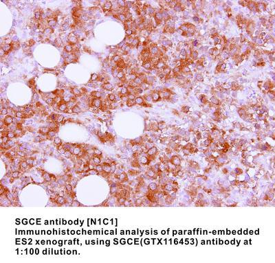 SGCE antibody [N1C1], GeneTex