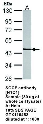 SGCE antibody [N1C1], GeneTex