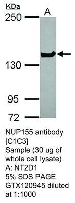 RB PAB TO NUP155