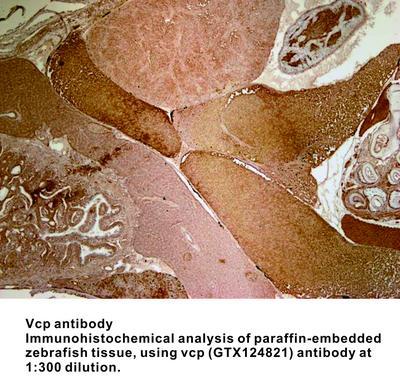 VCP antibody, GeneTex