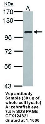 VCP antibody, GeneTex