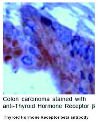 Thyroid Hormone Receptor beta antibody, GeneTex