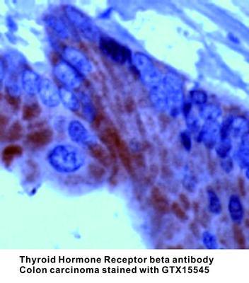 Thyroid Hormone Receptor beta antibody, GeneTex