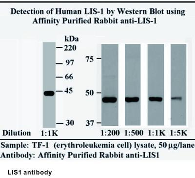 RB PAB TO LIS1