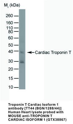 MS MAB TO TROPONIN T CARDIAC 1