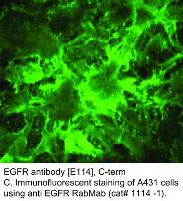 EGFR antibody [E114], C-term, GeneTex