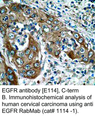 EGFR antibody [E114], C-term, GeneTex