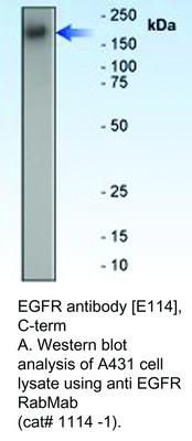 EGFR antibody [E114], C-term, GeneTex