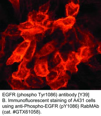 EGFR (phospho Tyr1086) antibody [Y39], GeneTex