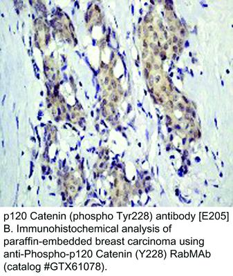 RB MAB TO P120 CATENIN (PY228)