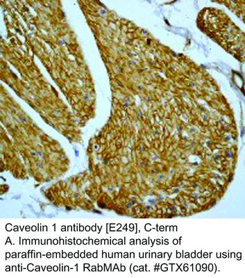 Caveolin 1 antibody [E249], C-term, GeneTex