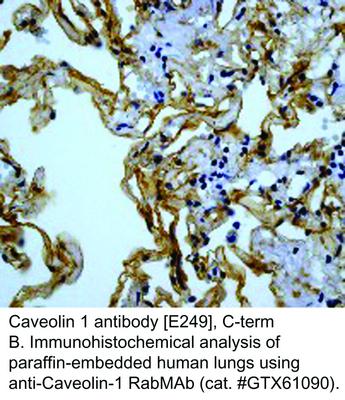 Caveolin 1 antibody [E249], C-term, GeneTex