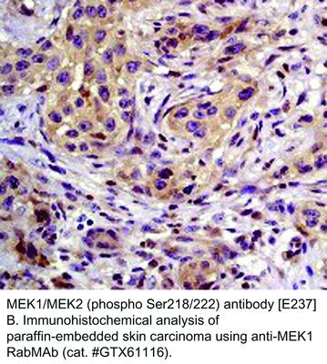 MEK1/MEK2 (phospho Ser218/222) antibody [E237], GeneTex