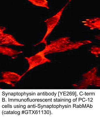 Synaptophysin antibody [YE269], C-term, GeneTex