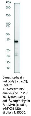 Synaptophysin antibody [YE269], C-term, GeneTex