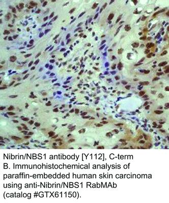 Nibrin/NBS1 antibody [Y112], C-term, GeneTex