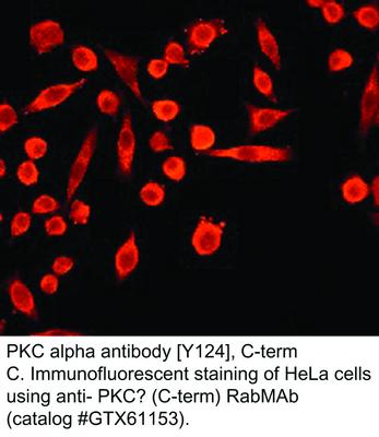 PKC alpha antibody [Y124], C-term, GeneTex