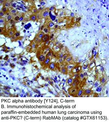 PKC alpha antibody [Y124], C-term, GeneTex