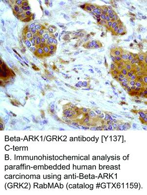 RB MAB TO BETA-ARK1/GRK2