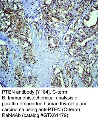 PTEN antibody [Y184], C-term, GeneTex