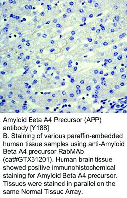 Amyloid Beta A4 Precursor (APP) antibody [Y188], GeneTex