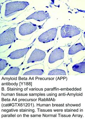 Amyloid Beta A4 Precursor (APP) antibody [Y188], GeneTex