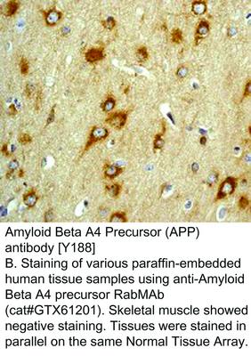 Amyloid Beta A4 Precursor (APP) antibody [Y188], GeneTex